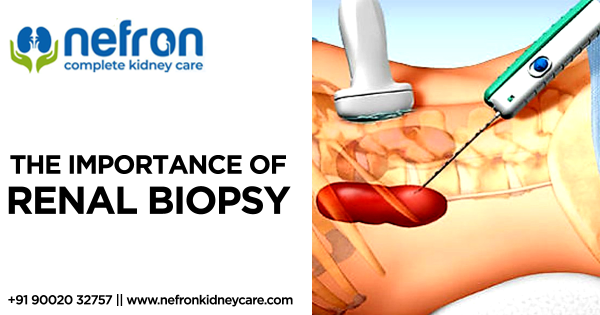 importance-of-renal-biopsy